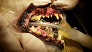 Teeth Cleaning